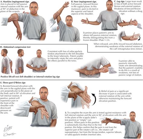 positive rotator cuff test